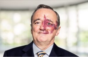 Mariano Barbacid investigador cancer