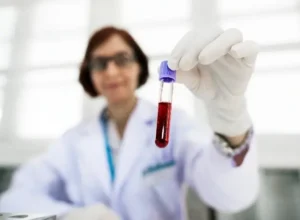 Mujer mayor laboratorio prueba sangre