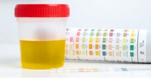 Prueba infección de orina